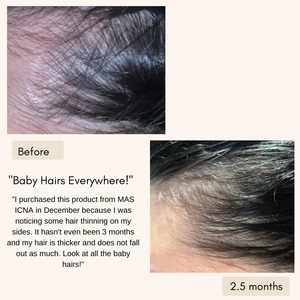 Moroccan Hair & Scalp Growth Oil
